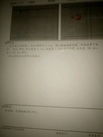 journal_insert_pic_593138908