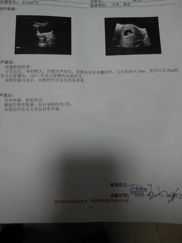 journal_insert_pic_596392979
