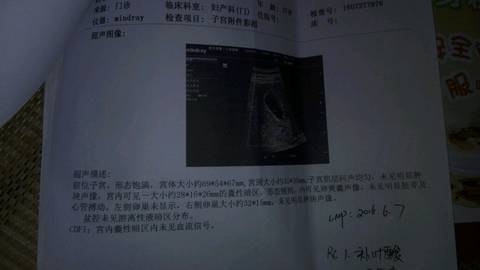 journal_insert_pic_596394841
