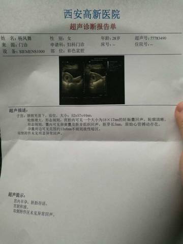 journal_insert_pic_598101528