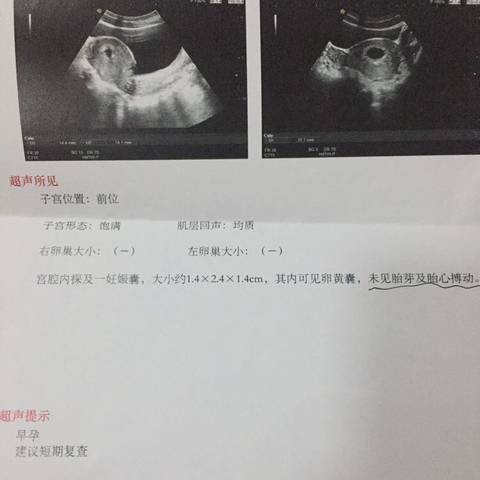 journal_insert_pic_599045768