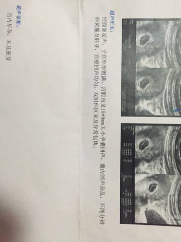 journal_insert_pic_599452083