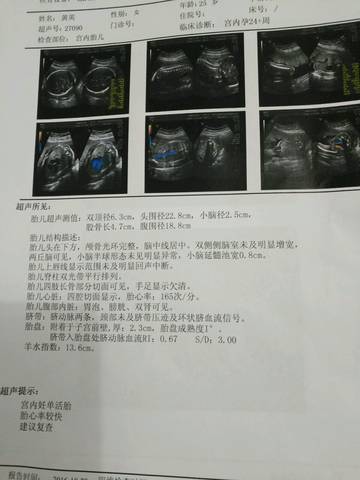 journal_insert_pic_599644073