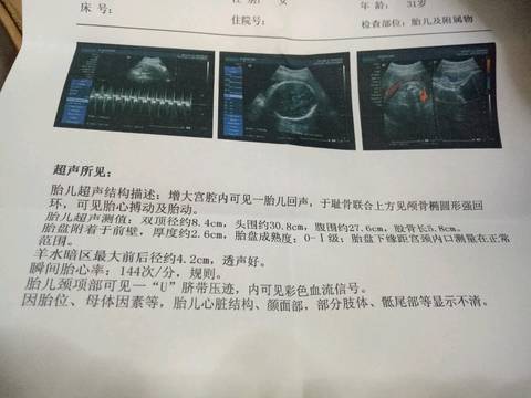 journal_insert_pic_600100543