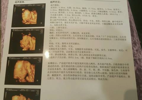 journal_insert_pic_600593158