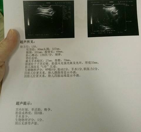 journal_insert_pic_600913357