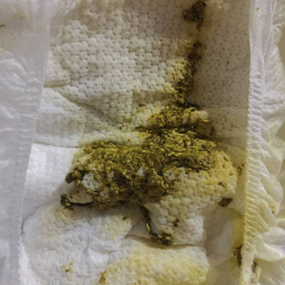 一个月宝宝吐奶瓣