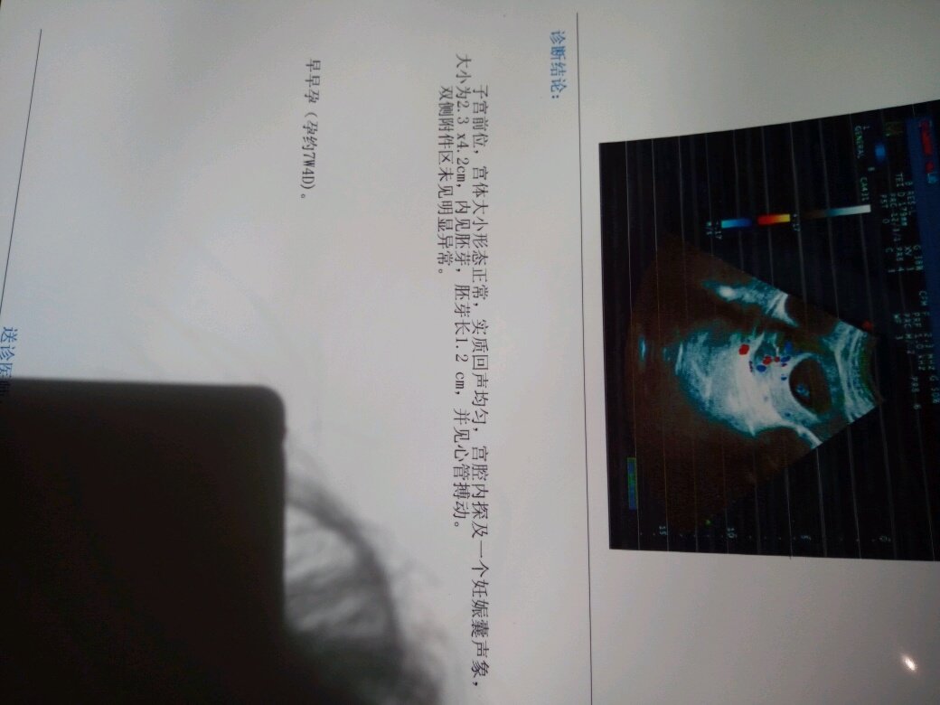 还愿接热呼呼的胎心胎芽‼
