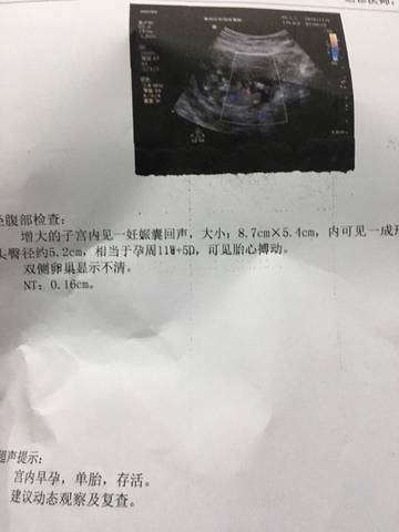 journal_insert_pic_603854443
