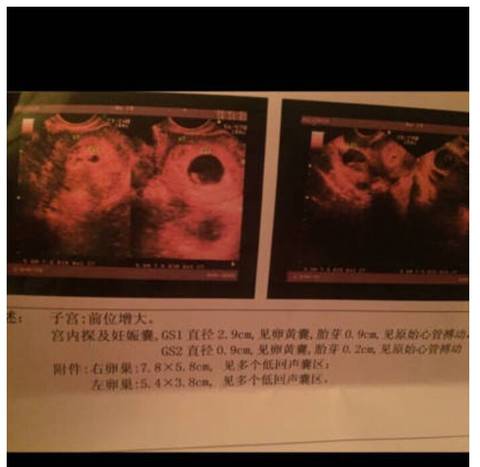 journal_insert_pic_604038787