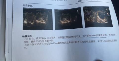 journal_insert_pic_607637278