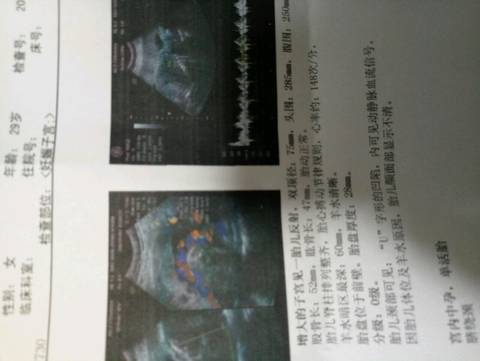 journal_insert_pic_608184669