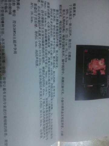 journal_insert_pic_609885176