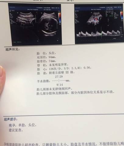 journal_insert_pic_611102698