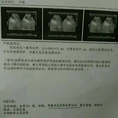 journal_insert_pic_611544656