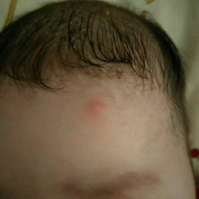 宝宝脑门中间有凸起是怎么回事？