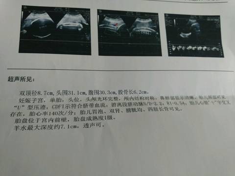 journal_insert_pic_612619022