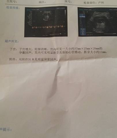 journal_insert_pic_619342503