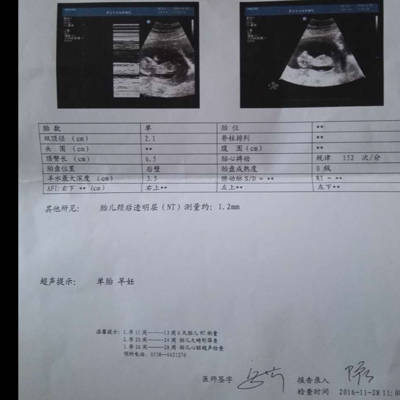 問答 懷孕期 樹友wo3yrf8o孕13周3天2016-12-04 推薦回答