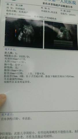 journal_insert_pic_620806566