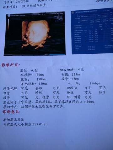 journal_insert_pic_622827543