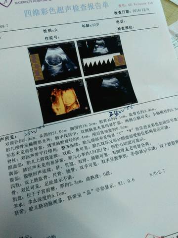 journal_insert_pic_622929424