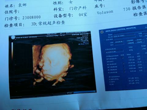 journal_insert_pic_622827542