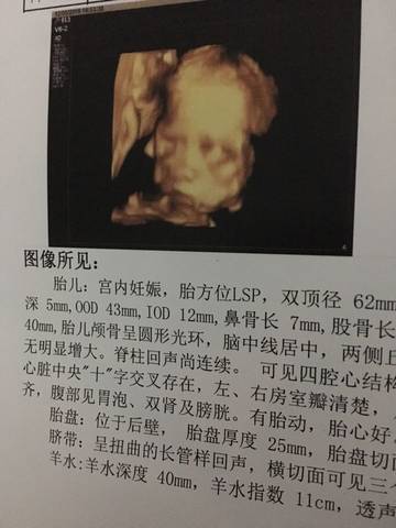 journal_insert_pic_623416651
