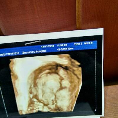 25周胎儿大小真实图片图片