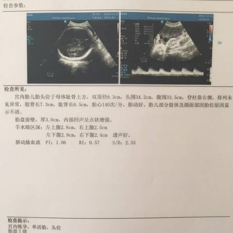 journal_insert_pic_625809963