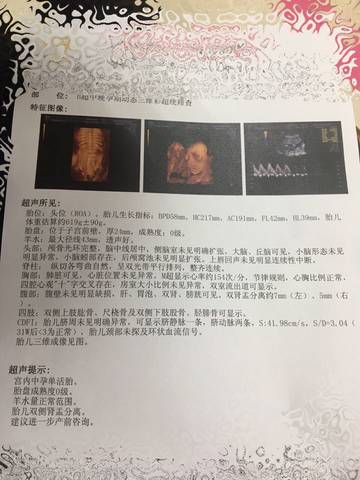 journal_insert_pic_627699551