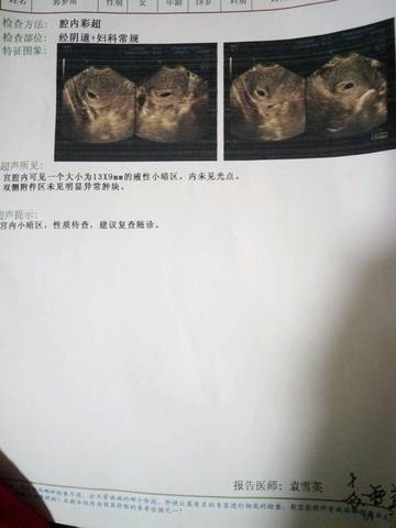 journal_insert_pic_627794374