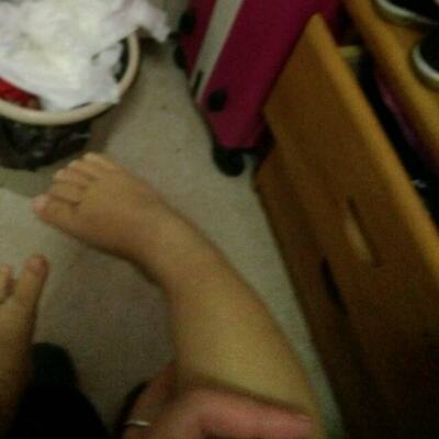 10个月孩子脚这样内拐正常吗 按平常大人的脚放松应该是直的吧