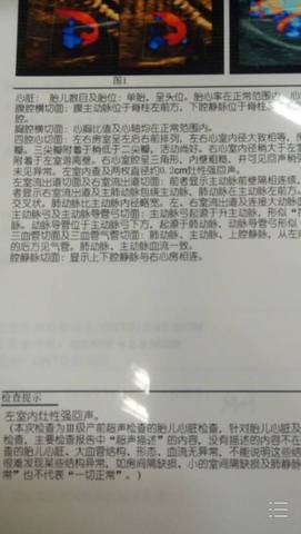 journal_insert_pic_629453810