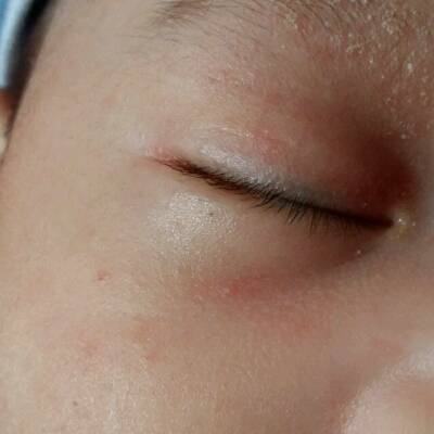 宝宝眼皮有点黑,这两天没怎麼睡好觉.