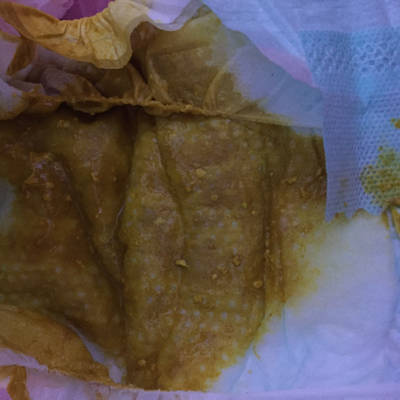 宝宝18天,母乳餵养,大便感觉有点稀,这正常吗?