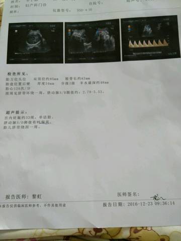 journal_insert_pic_631599114