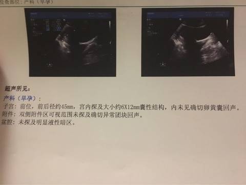 journal_insert_pic_631829721
