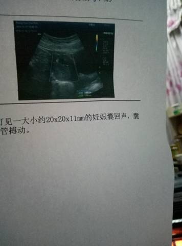 journal_insert_pic_634932194