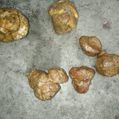 担心宝宝会得痔疮