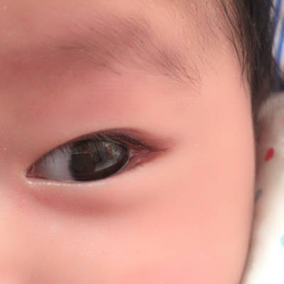 两个月宝宝瞳孔图图片