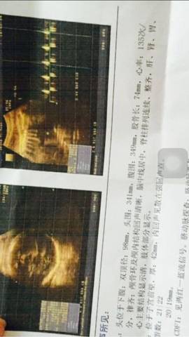 journal_insert_pic_637715659