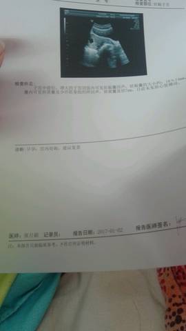 journal_insert_pic_638802477