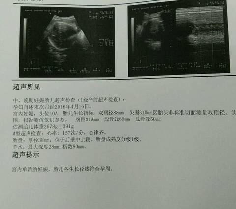 journal_insert_pic_640067432