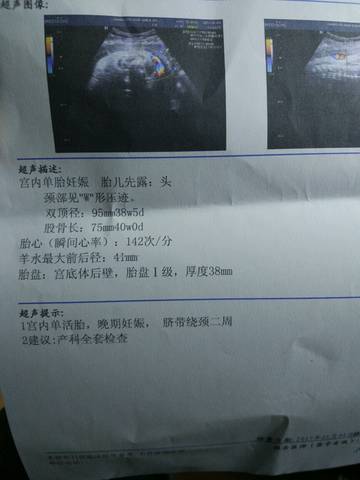 journal_insert_pic_640773302