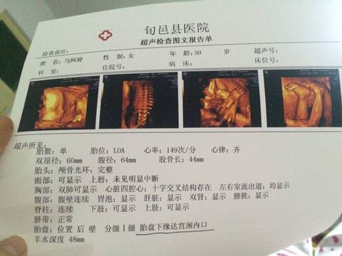 journal_insert_pic_640928244