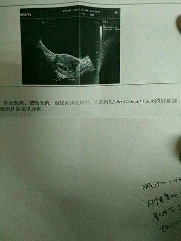 journal_insert_pic_641295999