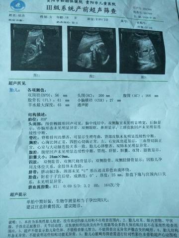 journal_insert_pic_641167422