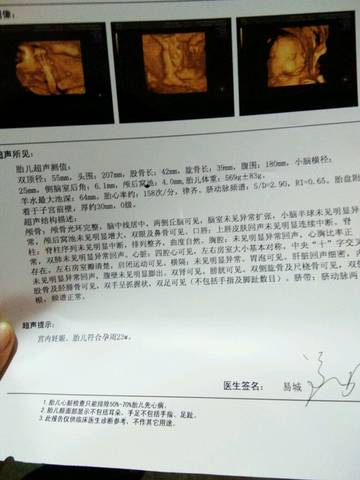 journal_insert_pic_641511120