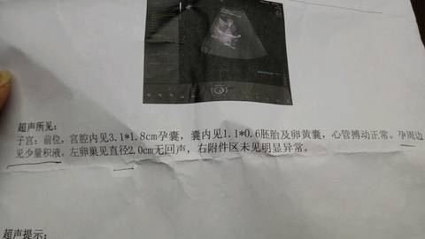 journal_insert_pic_642607069